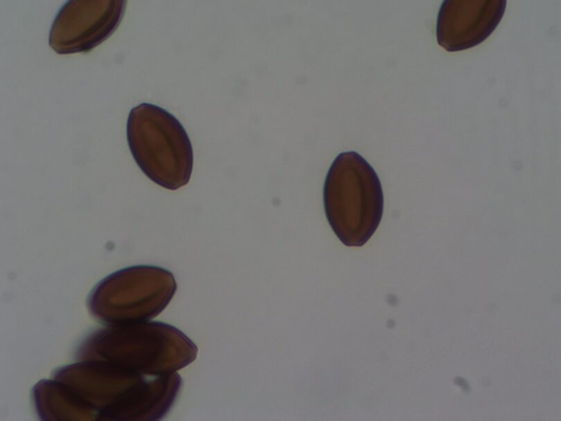 Ophryocystis elektroscirrha parasites under a microscope at 1000x magnification. (Photo by Maria Luisa Müller-Theissen)